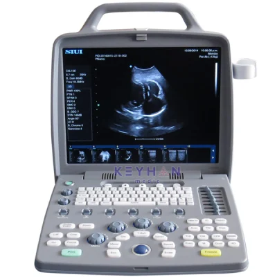 دستگاه سونوگرافی پرتابل suiu cts 8800